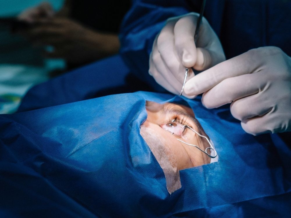 Procedimento de cirurgia refrativa a laser para correção da visão, mostrando uma das principais soluções sobre como diminuir o grau de miopia.