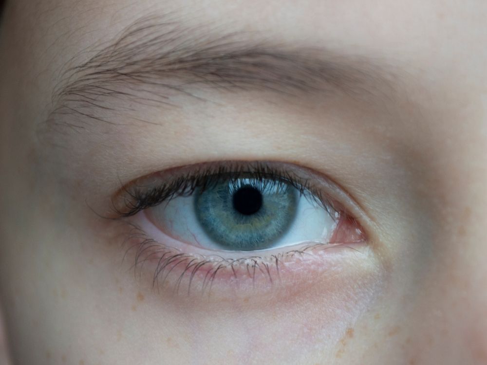 Olho infantil em destaque com lente de contato e atenção à saúde ocular, explicação de Criança pode usar lente de contato