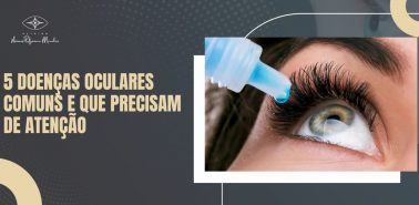 Doenças Oculares